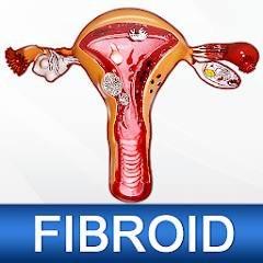 Uterine Fibroid Treatment Help 2.1 Mod (Pro)